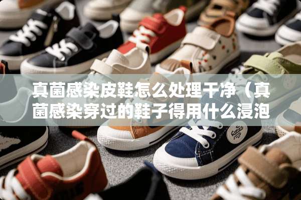 真菌感染皮鞋怎么处理干净（真菌感染穿过的鞋子得用什么浸泡）