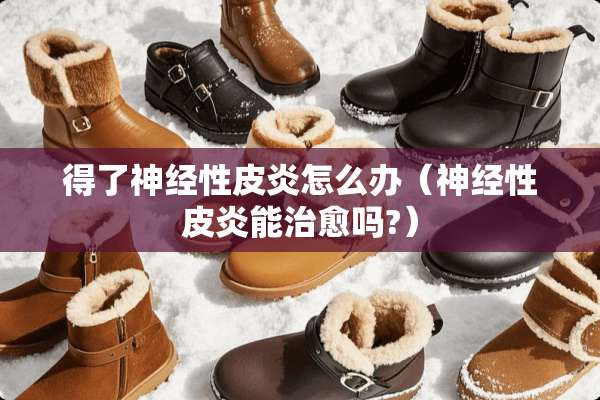 得了神经性皮炎怎么办（神经性皮炎能治愈吗?）