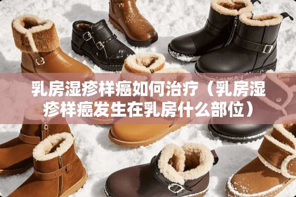 *房湿疹样癌如何治疗（*房湿疹样癌发生在*房什么部位）