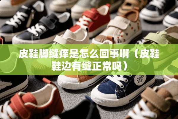 皮鞋脚缝痒是怎么回事啊（皮鞋鞋边有缝正常吗）