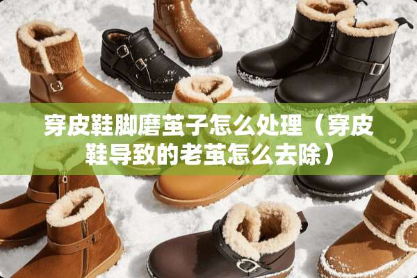 穿皮鞋脚磨茧子怎么处理（穿皮鞋导致的老茧怎么去除）