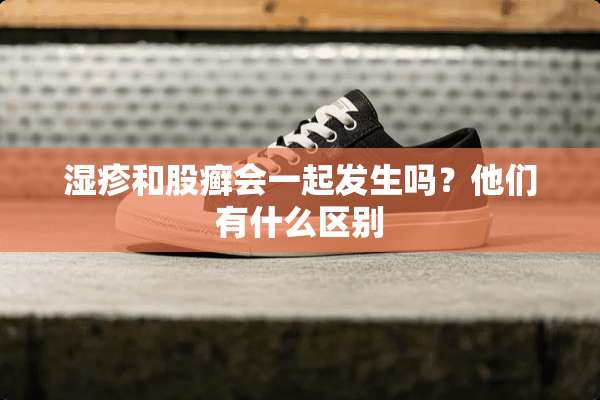 湿疹和股癣会一起发生吗？他们有什么区别